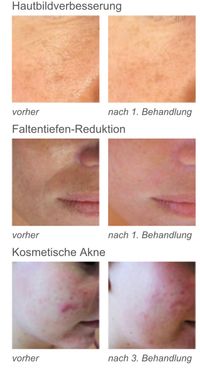 LDM Medical Spa in Mannheim für Faltenreduktion und Hautbildverbesserung